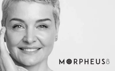 Morpheus 8 : Tout savoir au sujet de ses avantages, risques et résultats