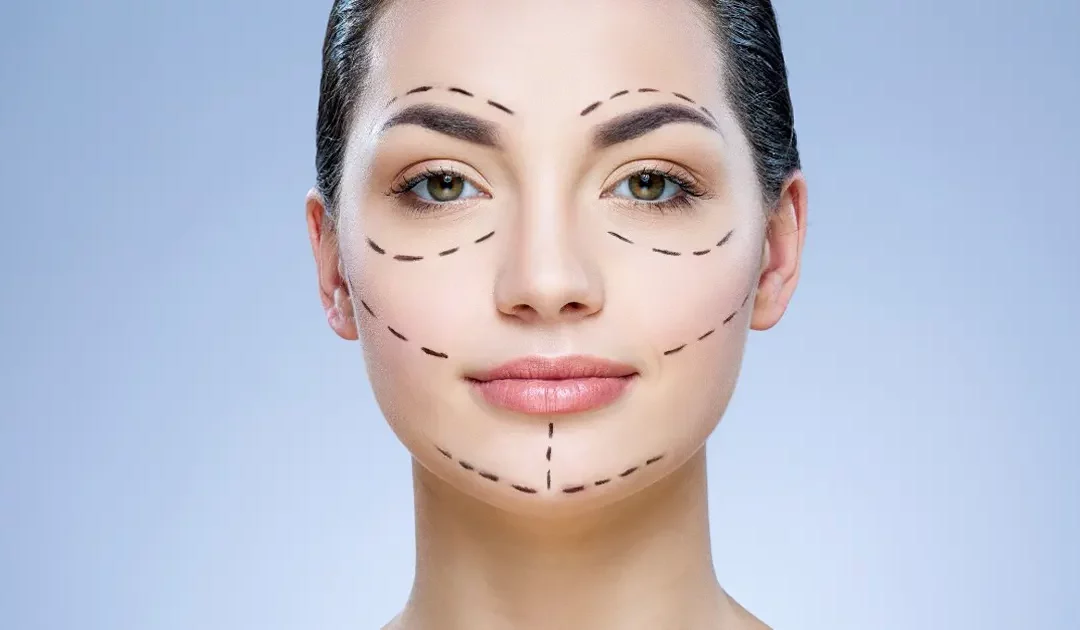 Tout ce qu’il y a à savoir au sujet du lipofilling du visage